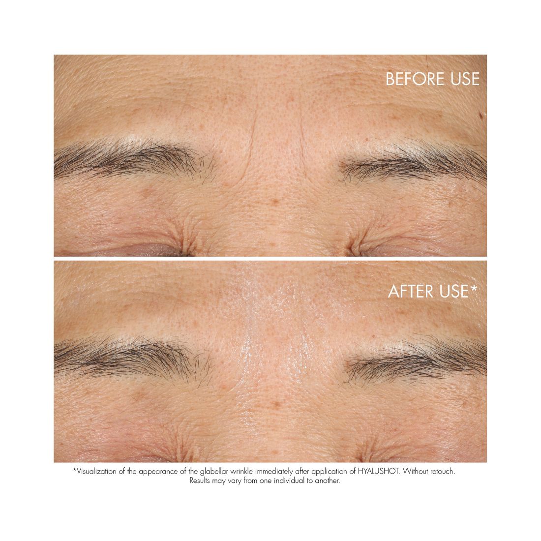 Capture Totale Hyalushot Wrinkle Corrector with Hyaluronic Acid