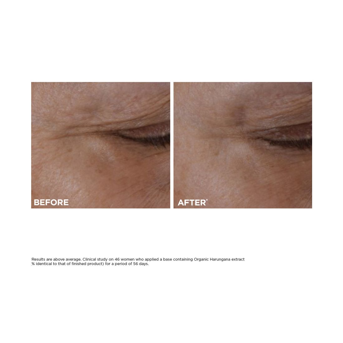 Total Eye Lift Eye Cream Refill for Firming, Wrinkles, Dark Circles & Puffiness, 0.5 oz.