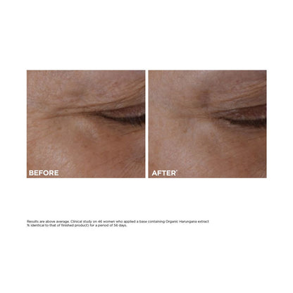 Total Eye Lift Eye Cream Refill for Firming, Wrinkles, Dark Circles & Puffiness, 0.5 oz.