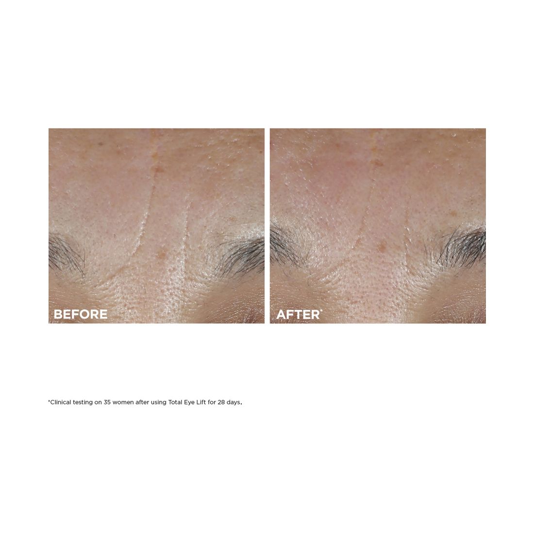 Total Eye Lift Eye Cream Refill for Firming, Wrinkles, Dark Circles & Puffiness, 0.5 oz.