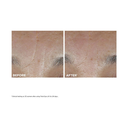Total Eye Lift Eye Cream Refill for Firming, Wrinkles, Dark Circles & Puffiness, 0.5 oz.
